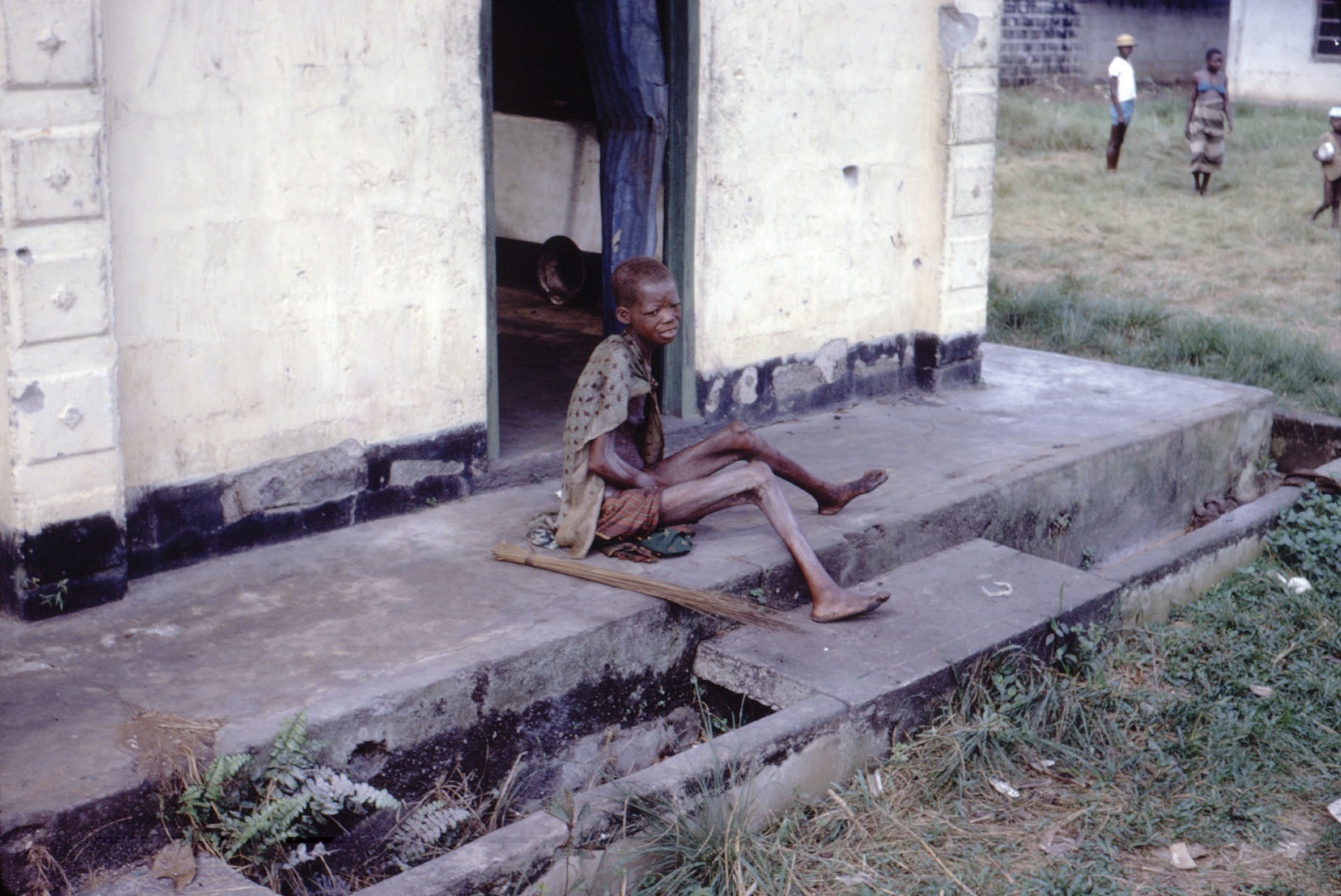 A very malnutritioned child sitting on a sidewalk. Bones are clearly visible under the skin.